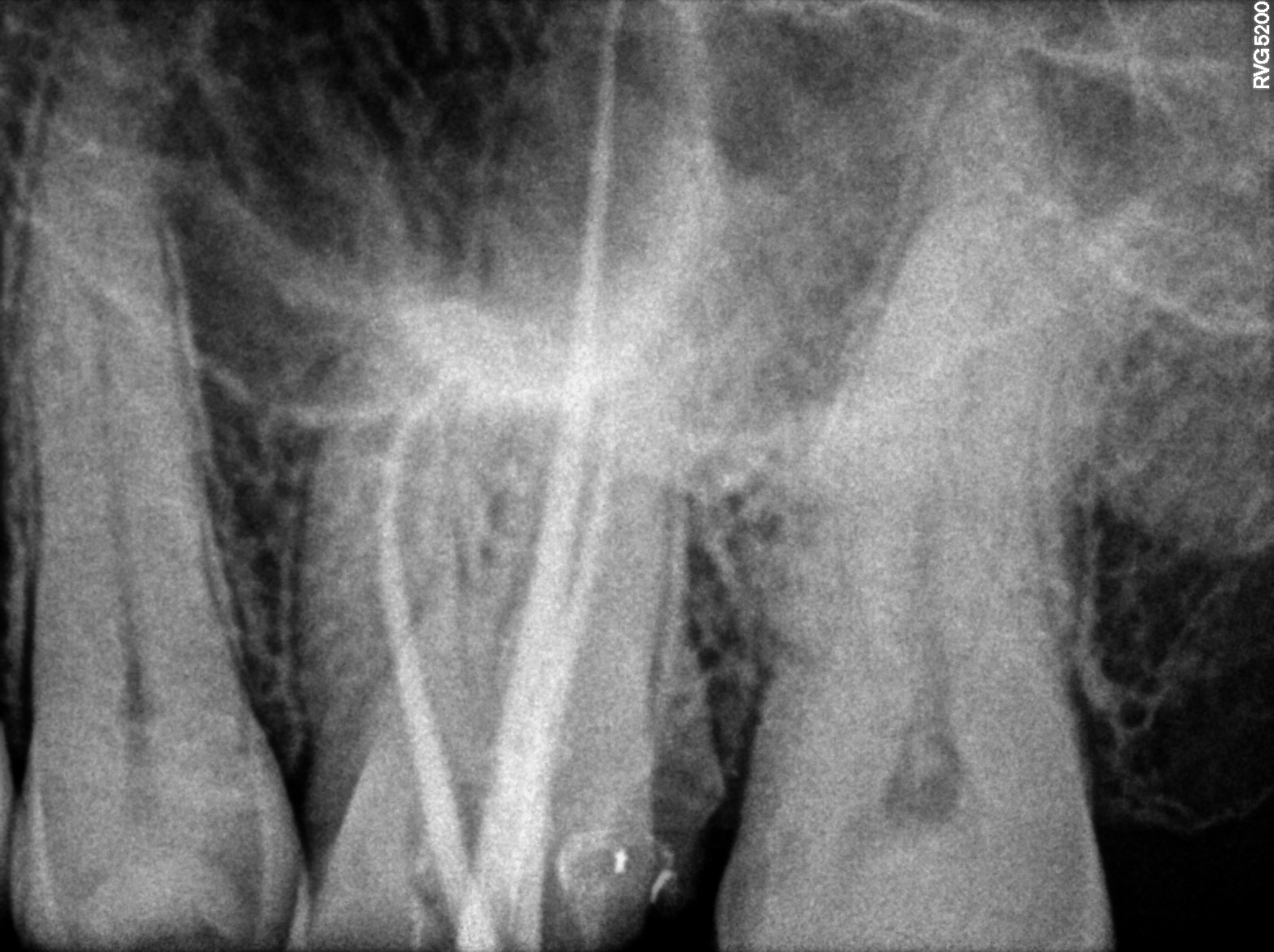 Dental X-ray